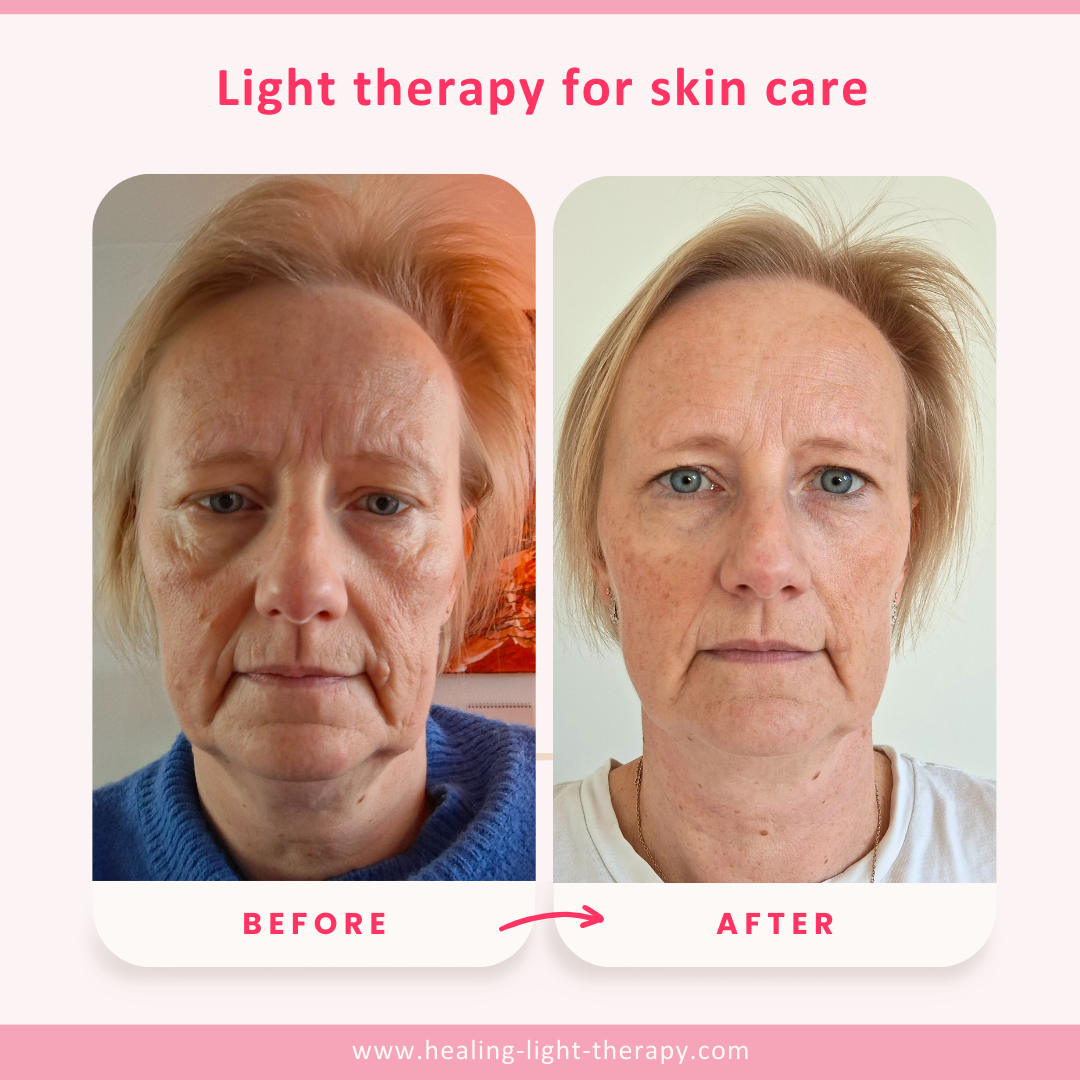 Three color beauty device for skin care