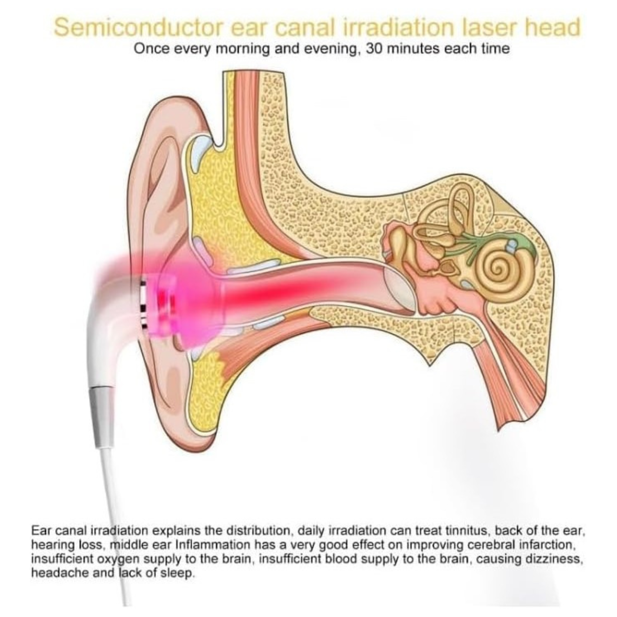 Light therapy for the treatment of ear disorders